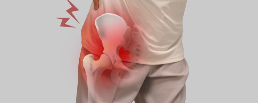 Alternatives to Hip Surgery Fort Myers