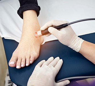 Plantar Fasciitis Fort Myers